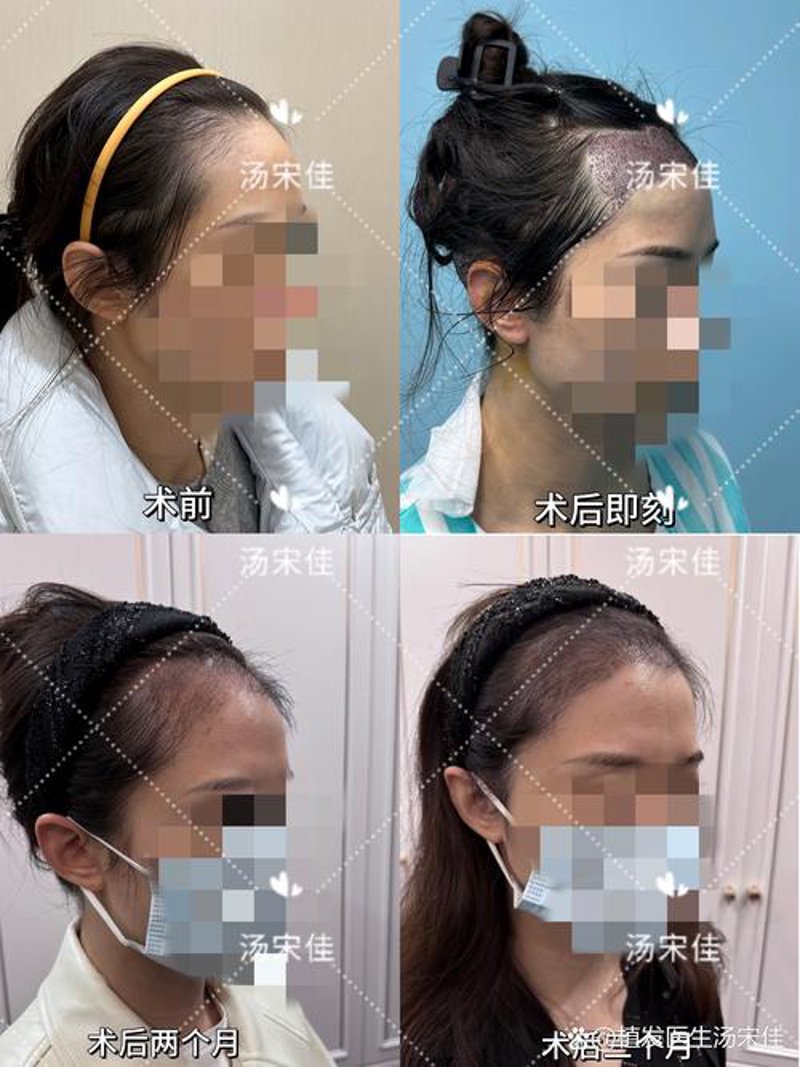 选择植发医院：一份从入门到精通的指南