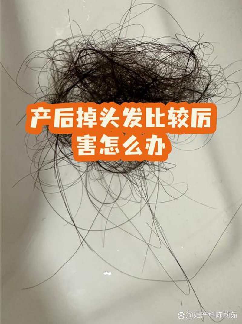 头发种植：一场关于美丽的革命